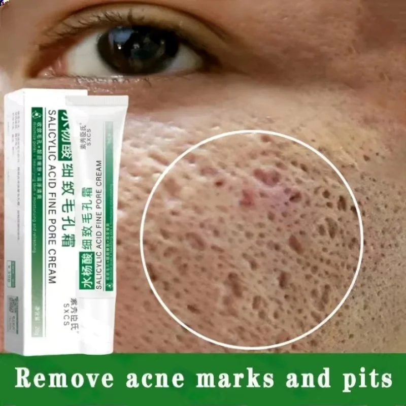 Salicylic Acid Blackhead Remover - Crema per la pulizia dei pori