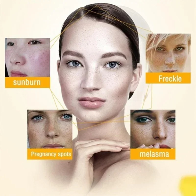 Rimuovere le rughe Crema Retin - Retinol Anti Wrinkle Cream recensione e prezzo