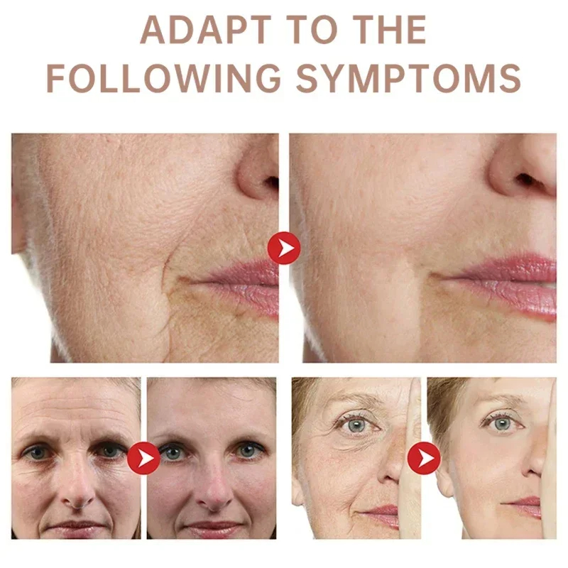 Rimuovere le rughe Crema Retin - Retinol Anti Wrinkle Cream recensione e prezzo