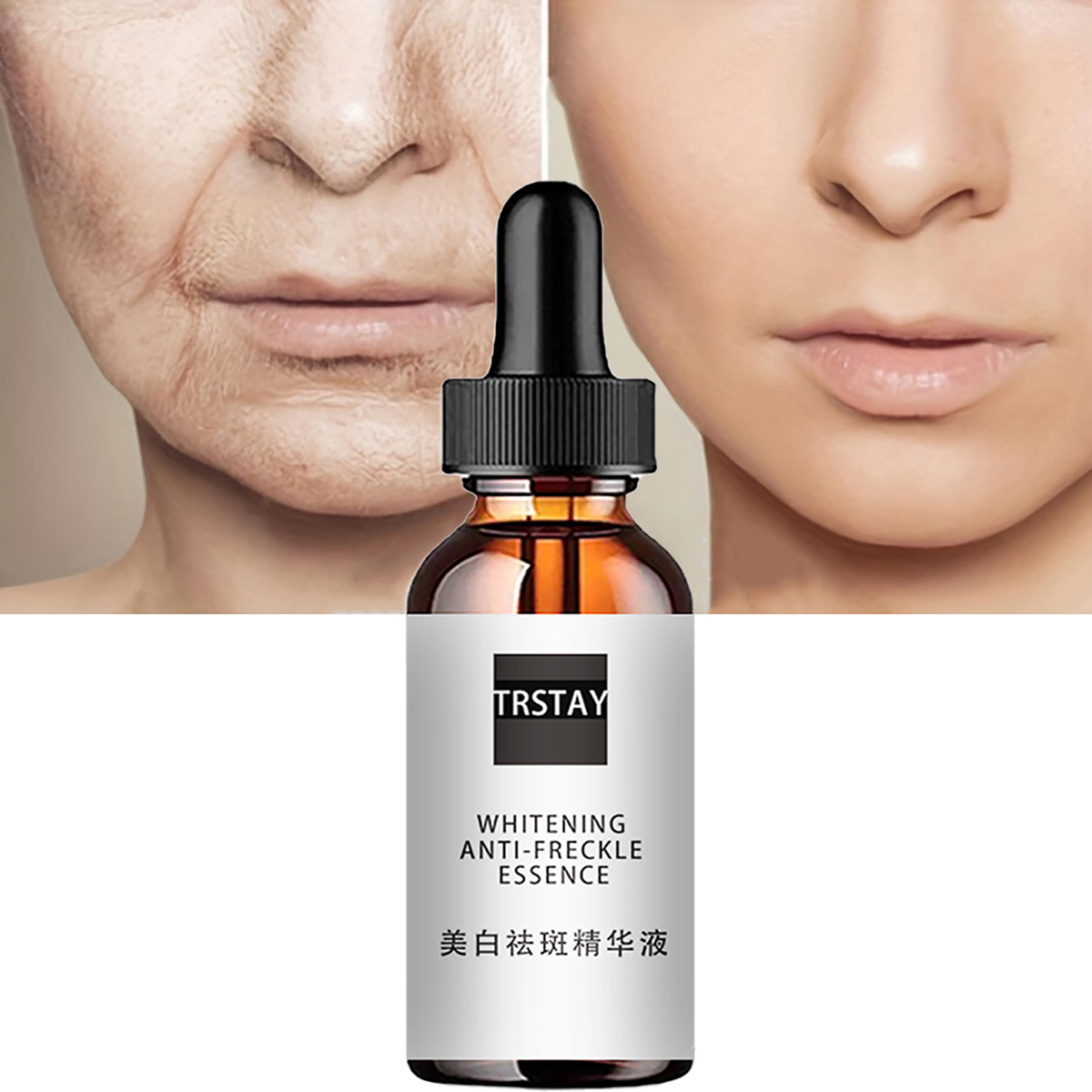 Niacinamide acido viso essenze - Niacinamide Pore Shrinking Essence recensione e prezzo