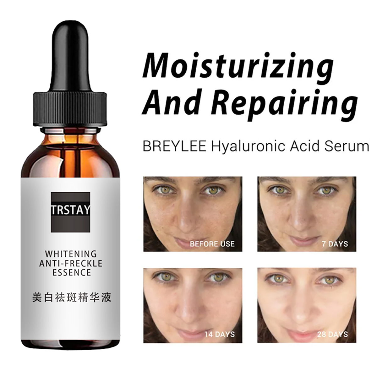 Niacinamide acido viso essenze - Niacinamide Pore Shrinking Essence recensione e prezzo