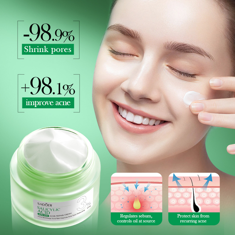 Crema per il Trattamento dell' - Salicylic Acid Blackhead Remover recensione e prezzo